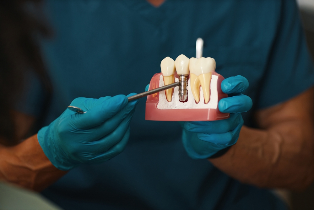 Rockhouse Technology. Dentist in Rexburg, ID. Dr. James C. Allen, DDS, Dr. Jaren M. Thueson, DDS. Rockhouse Dentistry